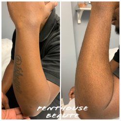 Penthouse Beaute - Before and after arm wax