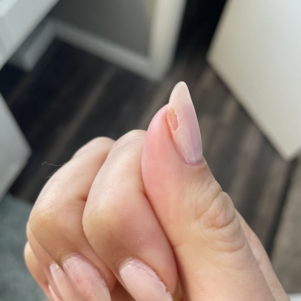 Lovely nails - Chipped nails - Nail Salons Near Me - Menifee, California Lovely nails - Chipped nails - Nail Salons Near Me - Menifee, California
