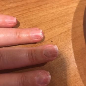 Pro Nails - Broken nail, damaged nail beads, bleeding cuticles. - Nail Salons Near Me - Jackson, Wyoming Pro Nails - Broken nail, damaged nail beads, bleeding cuticles. - Nail Salons Near Me - Jackson, Wyoming
