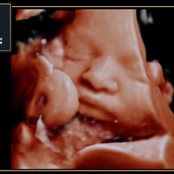 Angel Face Ultrasound Studio and Children’s Boutique - 3D/4D/5D/HD baby imaging studio located in Greensboro, NC!