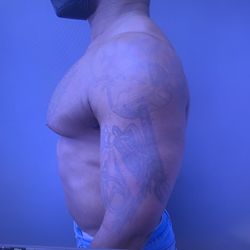 Mordcai Blau, M.D - Before