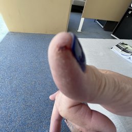Took off so much skin my fingers split! Took off so much skin my fingers split!