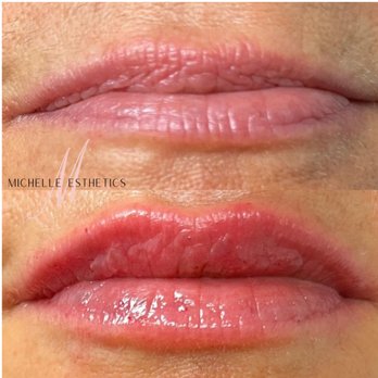 Michelle Esthetics - Medical Spas Near Me - Media, Pennsylvania