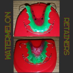 Chong Orthodontics - Cute Retainers: Watermelon!