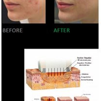 Tiffany M. Rice, NP - FORMA Discover younger acting skin with Tiffany Rice Nurse Practitioner ! - Nurse Practitioner Near Me - New York, New York Tiffany M. Rice, NP - FORMA Discover younger acting skin with Tiffany Rice Nurse Practitioner ! - Nurse Practitioner Near Me - New York, New York