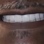 FastNewSmile
