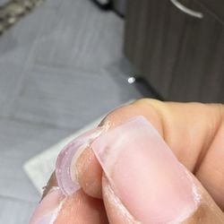 Allure Nail Lounge - My natural nails were so healthy before my terrible decision to give this salon another chance.