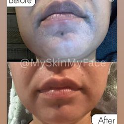 MySkinMyFace 