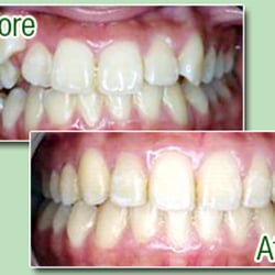 Greenlake Dental - Seattle