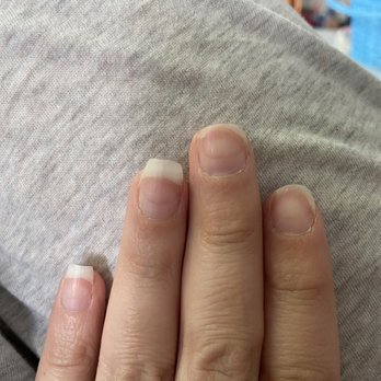 Nails by Nivea - Arches left behind by the dry mani grinding (1 mo later). The shorter nails broke in the past week at the edge of the arch as it grows. - Nail Salons Near Me - Miami, Florida