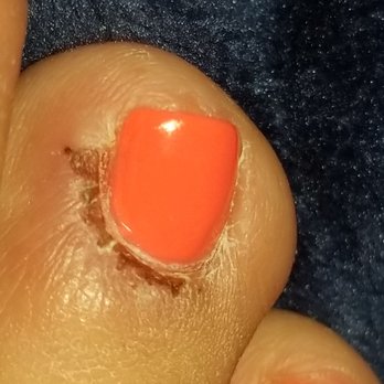 Happy Nails - 5 days later and still trying to heal - Nail Salons Near Me - Woodbridge, Virginia Happy Nails - 5 days later and still trying to heal - Nail Salons Near Me - Woodbridge, Virginia