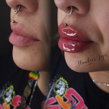Flawless Lips - Teeth Whitening Near Me Flawless Lips - Teeth Whitening Near Me