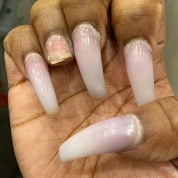Broken nail, lifting nails