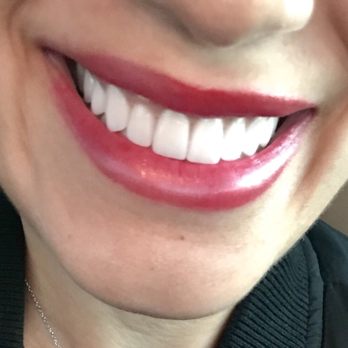 Floss - Cosmetic Dentists Near Me - San Diego, California Floss - Cosmetic Dentists Near Me - San Diego, California