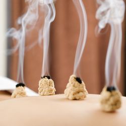 North End Acupuncture & Chinese Herbal Medicine - Moxibustion in Boston at North End Acupuncture