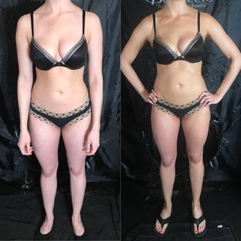 Top Notch Beauty - Before and After prior to full development. - Spray Tanning Near Me Top Notch Beauty - Before and After prior to full development. - Spray Tanning Near Me