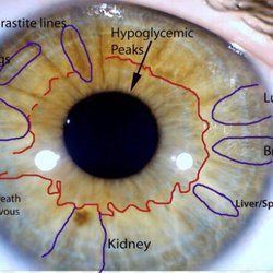 Long Island Center of Iridology
