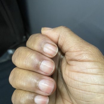Modern Nails & Spa - This dark red line has been across the top of my nails for over a month after going to modern nails. My nails broke off and have not grown. - Nail Salons Near Me - Arlington, Virginia