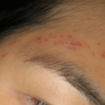 Nanu Threading - Look at what they did to my skin. Ugh! - Waxing Near Me - Costa Mesa, California Nanu Threading - Look at what they did to my skin. Ugh! - Waxing Near Me - Costa Mesa, California