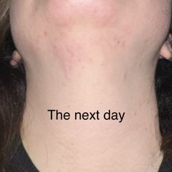 The day after appointment