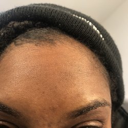 Angled Eyebrow Threading - I have a hole is the beginning of the left brow