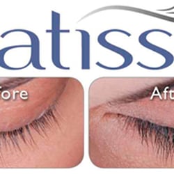 Interface Aesthetic Surgery Group - Latisse on sale!