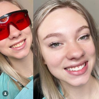 Pretty In Ink - Laser Whitening - Permanent Makeup Near Me - Bentonville, Arkansas Pretty In Ink - Laser Whitening - Permanent Makeup Near Me - Bentonville, Arkansas