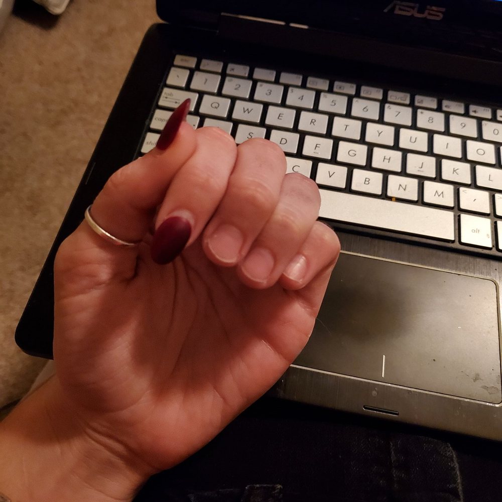 Ivy's Nails & Spa - One by one my nails have been lifting and peeling off, with no pain. - Nail Salons Near Me - Temecula, California Ivy's Nails & Spa - One by one my nails have been lifting and peeling off, with no pain. - Nail Salons Near Me - Temecula, California
