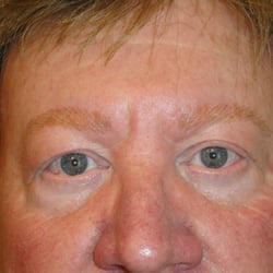 Another You Permanent Cosmetics - Post Eyebrows (Male)