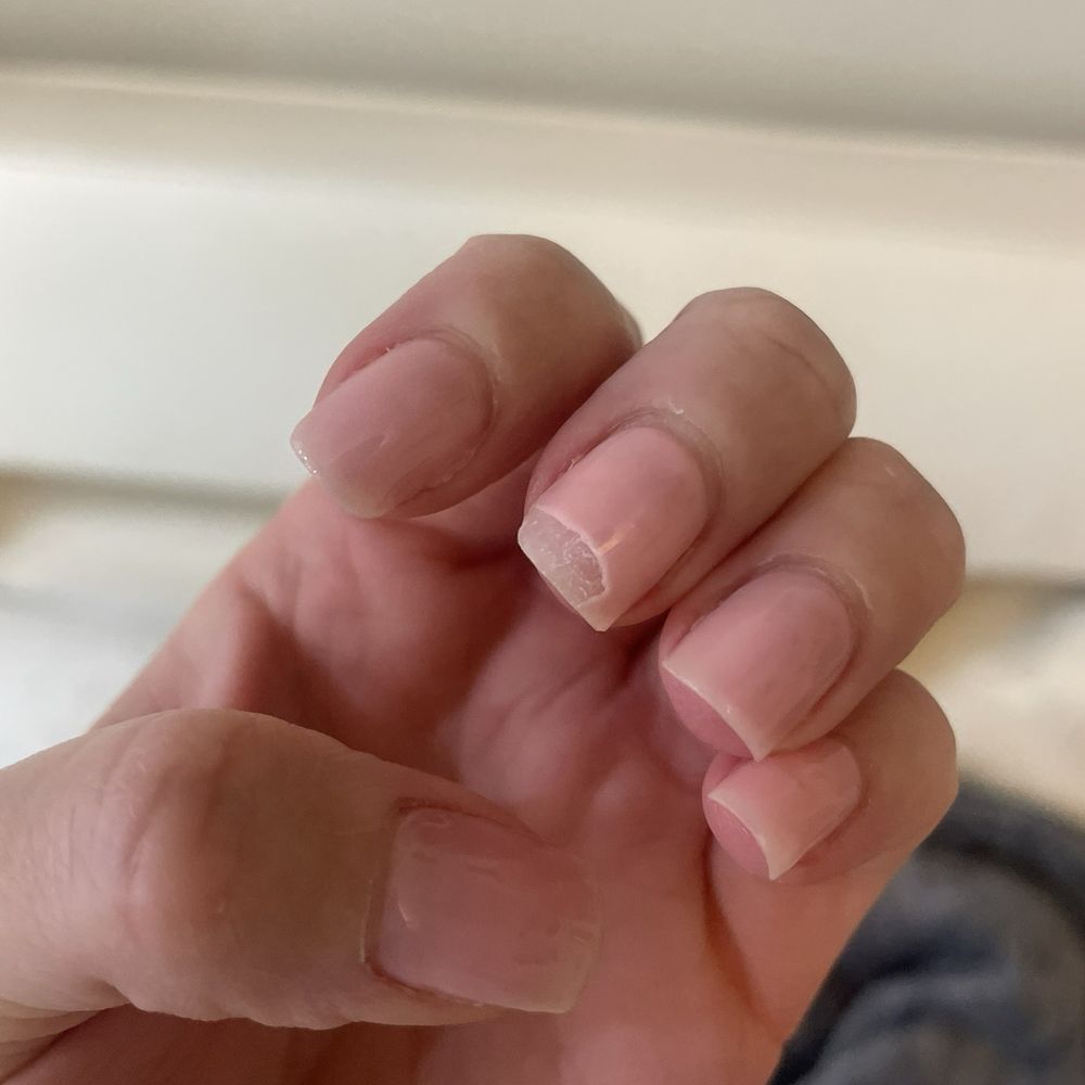 Edges of nails peeling Edges of nails peeling