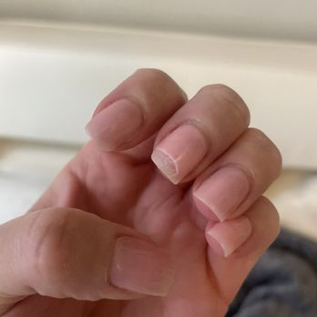 Fancy Nail Spa - Edges of nails peeling - Nail Salons Near Me - Chicago, Illinois