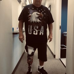 Coastal Prosthetics & Orthotics - My new leg