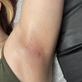 Bare Skin by Jocy - Underarm wax - Waxing Near Me - Stockton, California