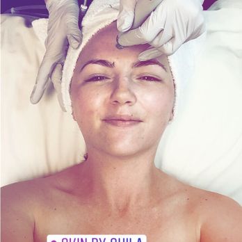 Skin By Shila - Hydro facial - Skin Care Near Me - Costa Mesa, California Skin By Shila - Hydro facial - Skin Care Near Me - Costa Mesa, California