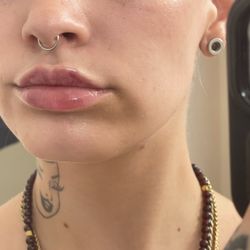 Lip filler