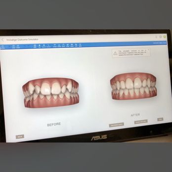 Visser Britt E Dr Orthdntst - Invisalign - Orthodontists Near Me - Virginia Beach, Virginia Visser Britt E Dr Orthdntst - Invisalign - Orthodontists Near Me - Virginia Beach, Virginia