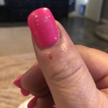 Jade Nails - Horrible infection they said we will give me $17 but refused to do my nails Then after 4 days one nail was falling off already!! - Nail Salons Near Me - Lake Elsinore, California Jade Nails - Horrible infection they said we will give me $17 but refused to do my nails Then after 4 days one nail was falling off already!! - Nail Salons Near Me - Lake Elsinore, California