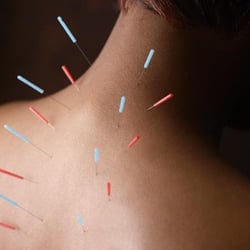 Ballston Chiropractic and Acupuncture