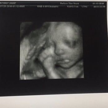 Before the Stork 4D - 27 weeks! - Ultrasound Imaging Centers Near Me - Anaheim, California Before the Stork 4D - 27 weeks! - Ultrasound Imaging Centers Near Me - Anaheim, California