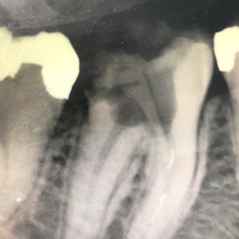 Number One Dental Group - Look At The Canal !! - General Dentistry Near Me - Commerce, California Number One Dental Group - Look At The Canal !! - General Dentistry Near Me - Commerce, California