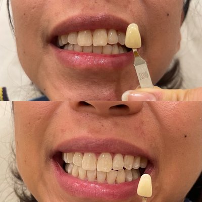 ChillRx Cryotherapy Montclair