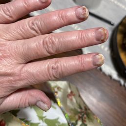 Fungus after a visit to Nail Care in Monroe