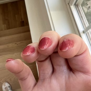Gloss Bar - Edges of nails not painted. - Waxing Near Me - Washington, DC, District of Columbia Gloss Bar - Edges of nails not painted. - Waxing Near Me - Washington, DC, District of Columbia