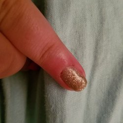 The day after...the one is cut all the way around the nail.