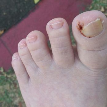 Friedman DPM A Podiatry , Rory J - Podiatrists Near Me - Long Beach, California Friedman DPM A Podiatry , Rory J - Podiatrists Near Me - Long Beach, California