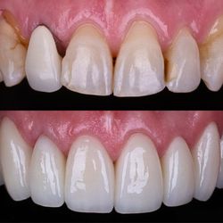 Otter Creek Dental