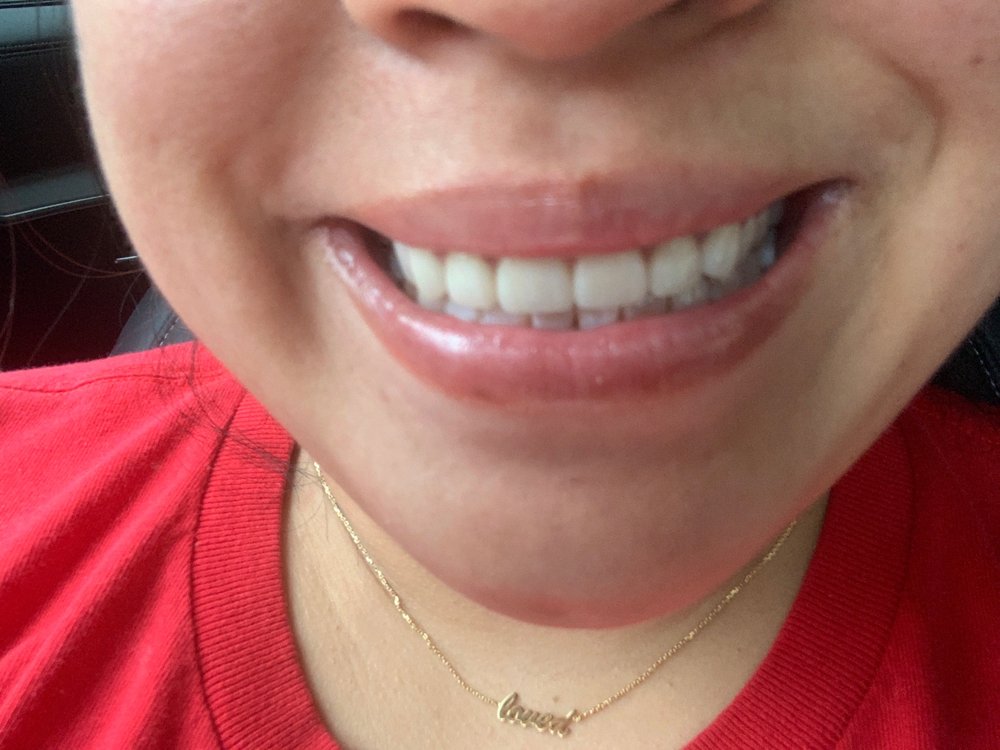 APEX DENTAL CARE 11 Photos & 38 Reviews 3565 Lee Hwy, Arlington