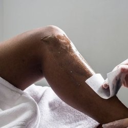Hair Removal