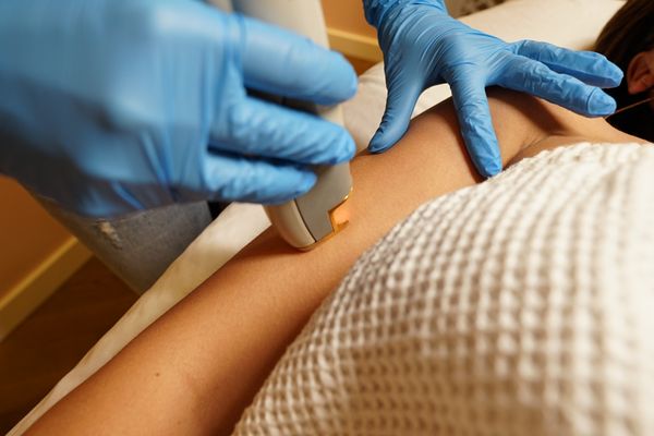 Laser Hair Removal at Balm - We offer Full Body Laser Hair removal at Balm. From head to toe, Brazilian to fingers and toes, we have you covered. A la carte and Packages are both available. We offer free laser consultations to discuss treatment options best for you.