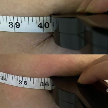 Rated R Esthetics - Results after 1 session of EMS body sculpting - Eyelash Service Near Me - San Jose, California Rated R Esthetics - Results after 1 session of EMS body sculpting - Eyelash Service Near Me - San Jose, California